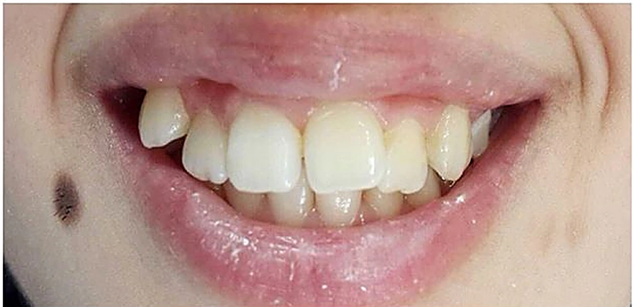 Dental treatment before