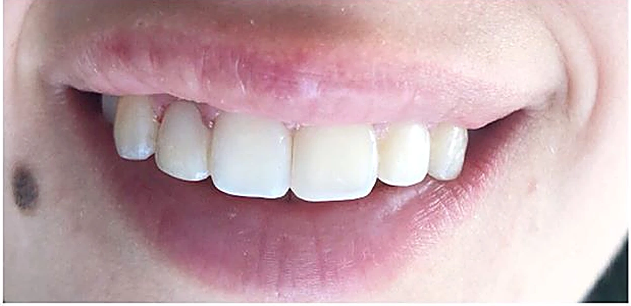 Dental treatment after