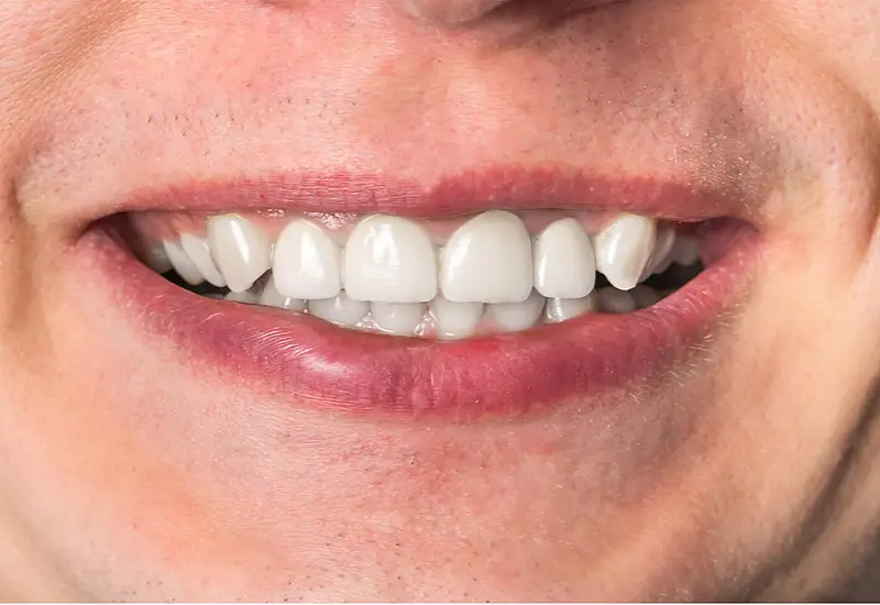 Dental treatment after