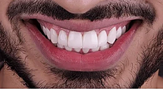 Dental treatment after