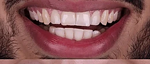 Dental treatment before